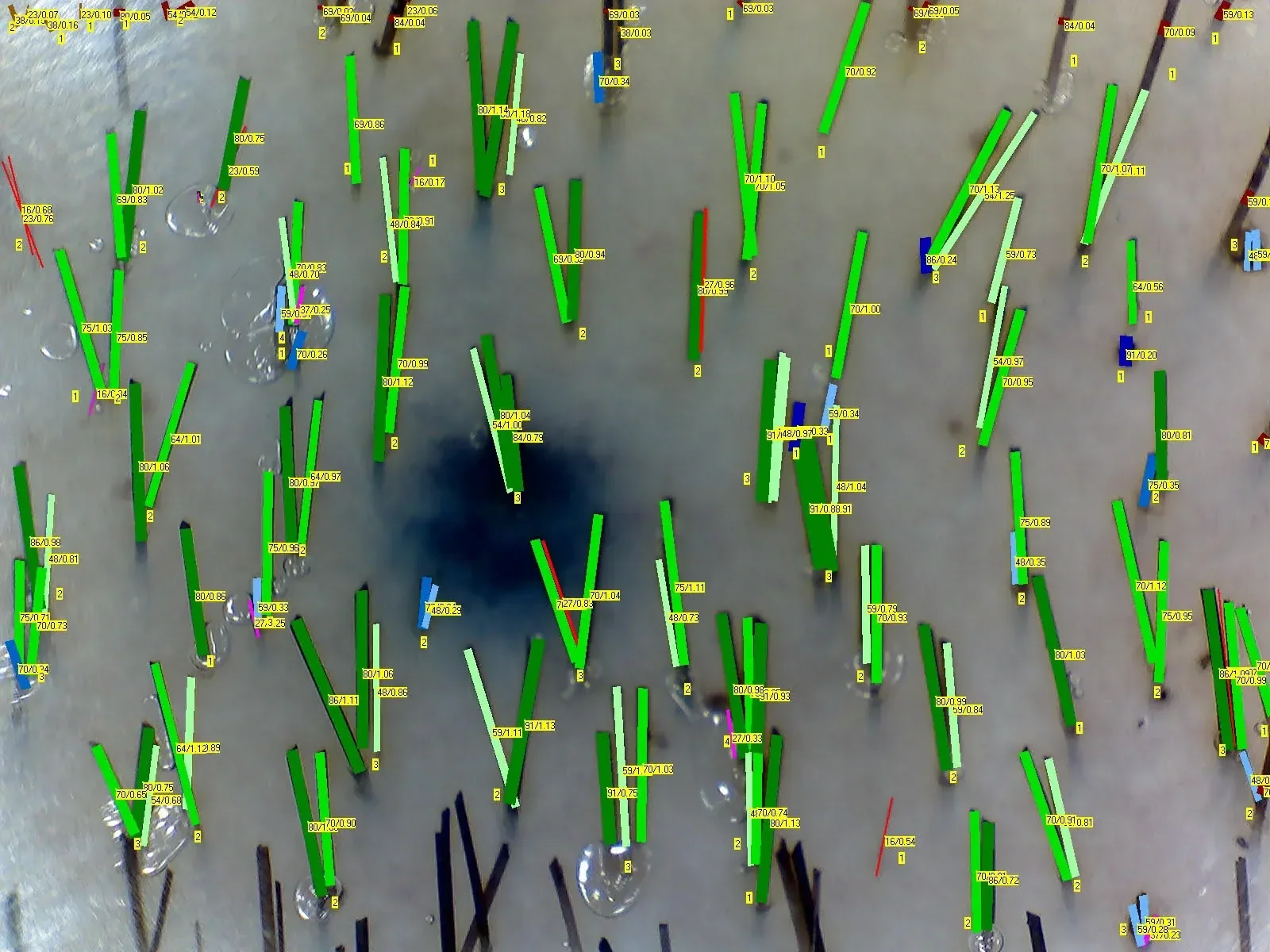 Computerized phototrichogram showing individual hairs marked for measurement and counting.