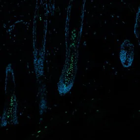 Fluorescence microscopy of hair follicles showing GFP-labelled signalling activity.